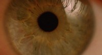 Pohled do bělma